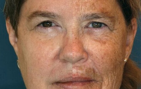 Kako pušenje utječe na vaš izgled?