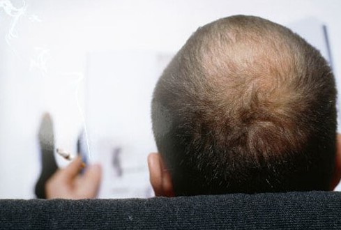 Kako pušenje utječe na vaš izgled?