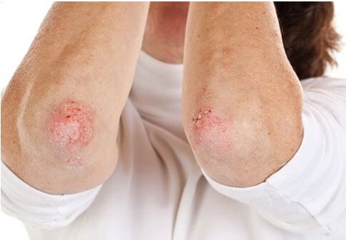 Kako pušenje utječe na vaš izgled?