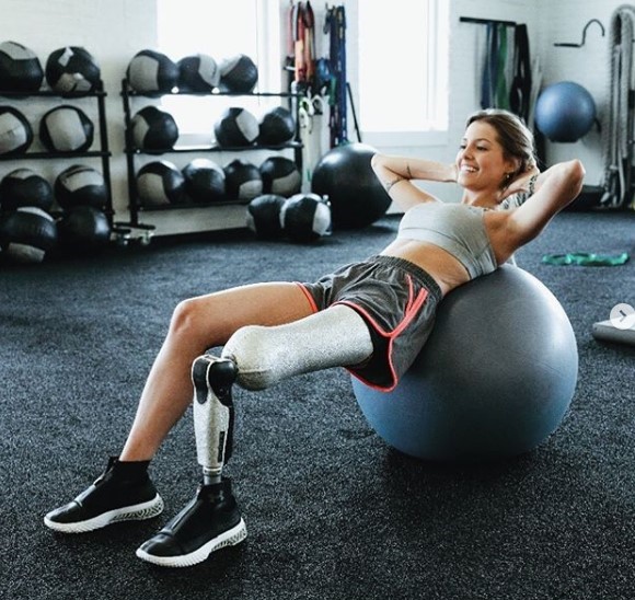 Brazilski fitness model sa nevjerovatnom pričom