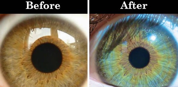 Šta može promijeniti boju vaših očiju?