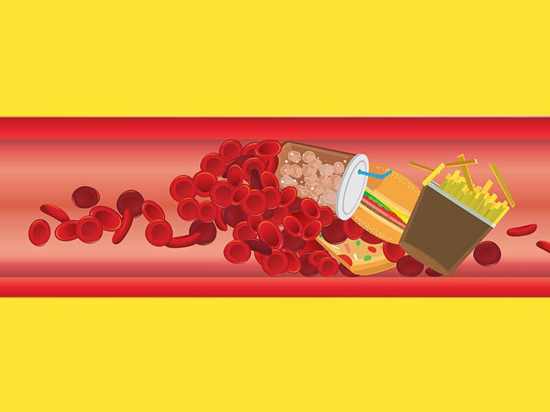 Svakodnevne navike koje mogu smanjiti rizik od moždanog udara Svakodnevne navike koje mogu smanjiti rizik od moždanog udara