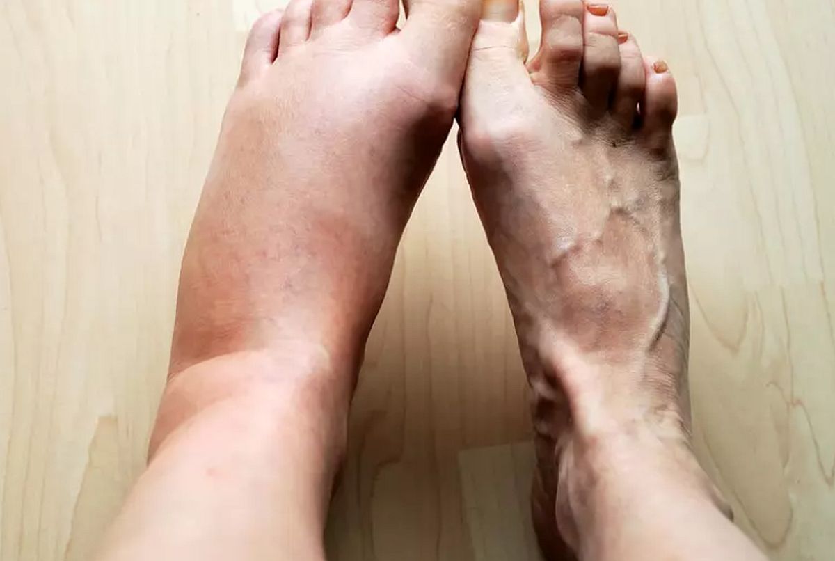 Gubitak kose, glavobolja i ostali simptomi koje ne trebate ignorisati Gubitak kose, glavobolja i ostali simptomi koje ne trebate ignorisati