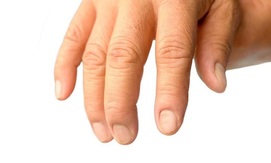 Evo šta vam vaši nokti govore o zdravlju