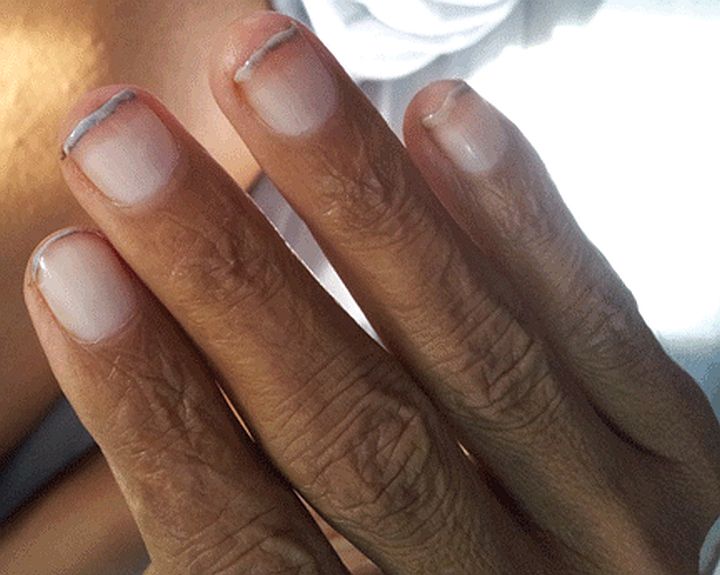 Evo šta vam vaši nokti govore o zdravlju