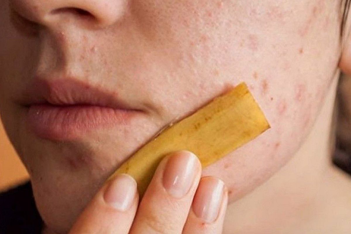Korisni trikovi kako se kora banane može iskoristiti