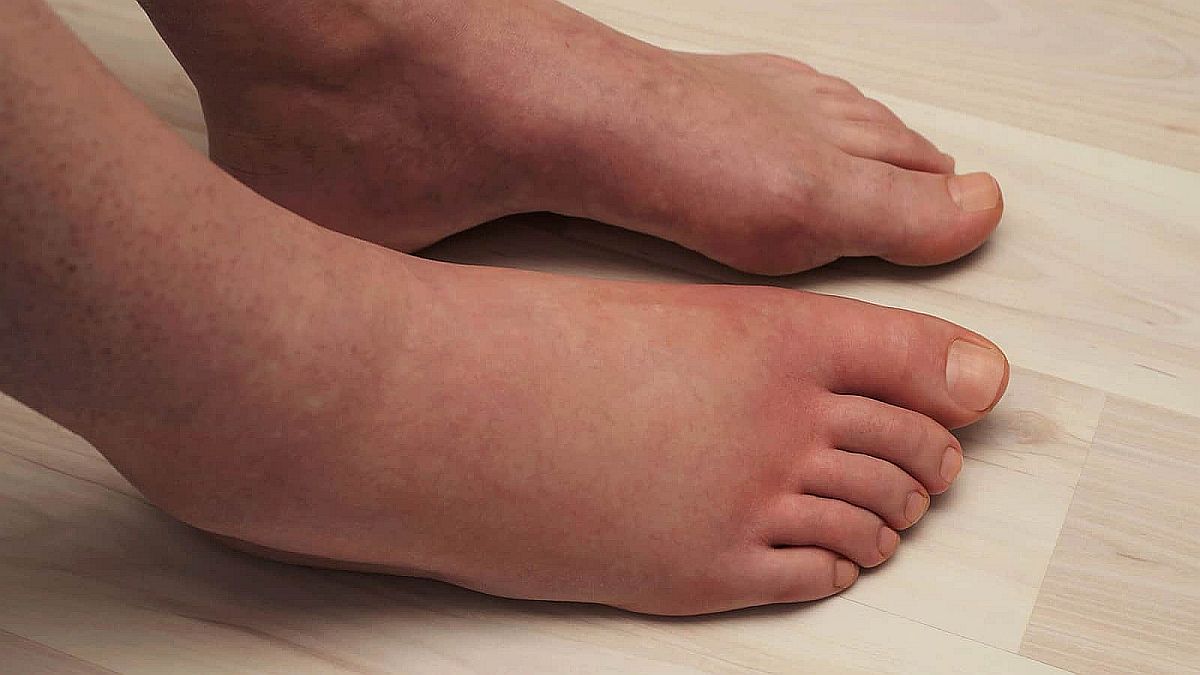 Problemi sa nogama mogu ukazivati na neke od ovih zdravstvenih problema