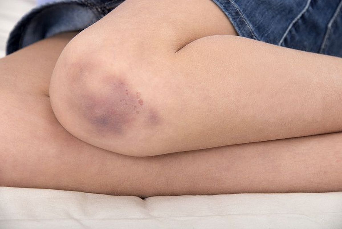 Problemi sa nogama mogu ukazivati na neke od ovih zdravstvenih problema