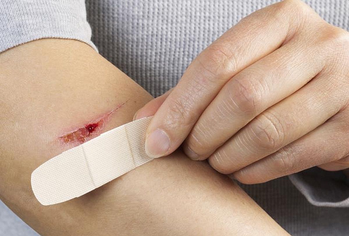 Pet znakova oslabljenog imuniteta