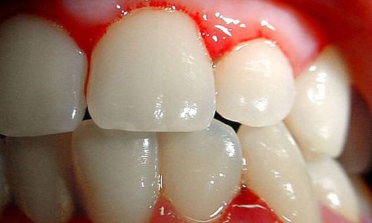 Prepoznajte ih: Signali koje nam šalje naše tijelo