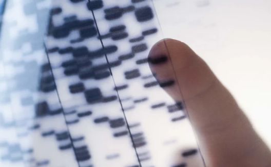 Zašto gubim kosu? Mogući odgovori na često pitanje Zašto gubim kosu? Mogući odgovori na često pitanje