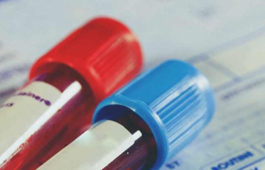 Zašto gubim kosu? Mogući odgovori na često pitanje Zašto gubim kosu? Mogući odgovori na često pitanje