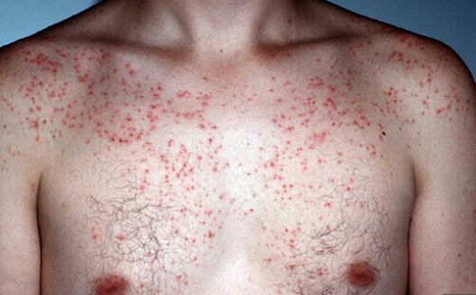 Ono što maslačak sve liječi ni jedan lijek ne može Ono što maslačak sve liječi ni jedan lijek ne može