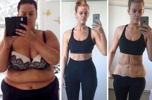 Oni su živi dokaz šta volja i rad mogu napraviti